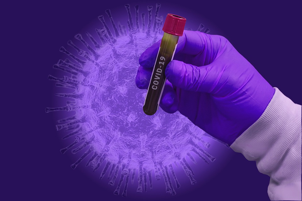 O´Higgins registra 88 nuevos casos de coronavirus