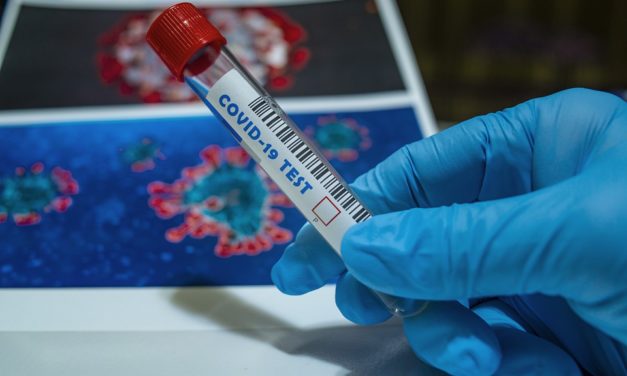 O´Higgins registró 77 nuevos casos de coronavirus este lunes