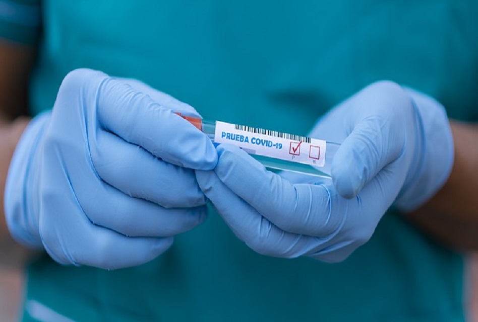 O´Higgins reporta 2 fallecidos y 48 nuevos casos de coronavirus