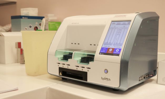 Hospital Regional procesará mil exámenes PCR diarios
